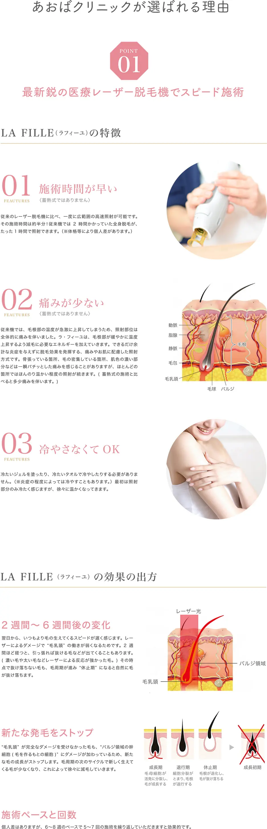 あおばクリニックは選ばれる理由、人気の医療レーザー脱毛機で、施術時間が早い、痛みが少ない、冷やさなくてOK